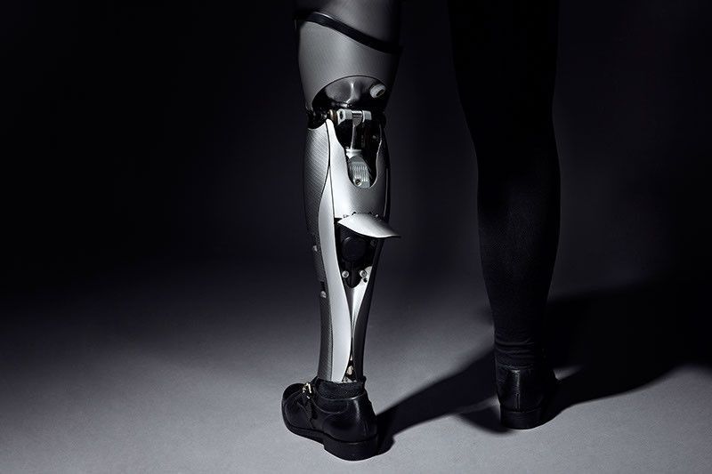 proteza nogi