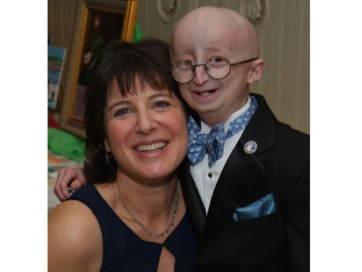 Progeria_sam_berns